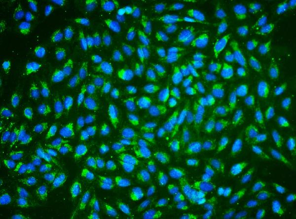 3 - Anti-ALDH2 Antibody Picoband™(monoclonal, 6H2) ABO16588