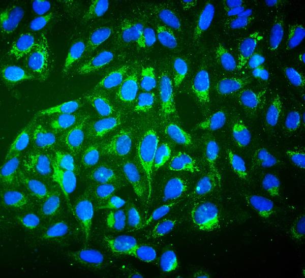 3 - Anti-ALDH2 Antibody Picoband™(monoclonal, 6H2) ABO16588