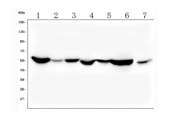 1 - Anti-ALDH2 Antibody Picoband™(monoclonal, 6H2) ABO16588