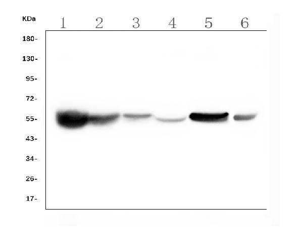 1 - Anti-ALDH2 Antibody Picoband™(monoclonal, 6H2) ABO16588