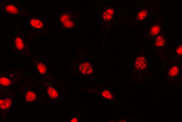 3 - Anti-AREB6/ZEB1 Antibody Picoband™ (monoclonal, 8B12D7) ABO16590