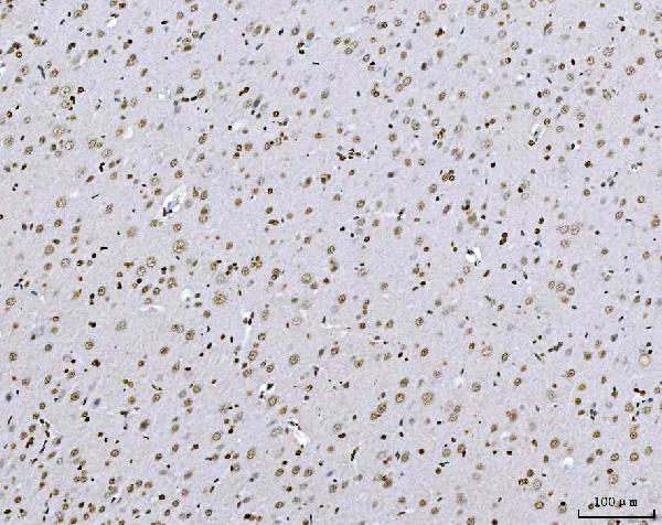 2 - Anti-AREB6/ZEB1 Antibody Picoband™ (monoclonal, 8B12D7) ABO16590