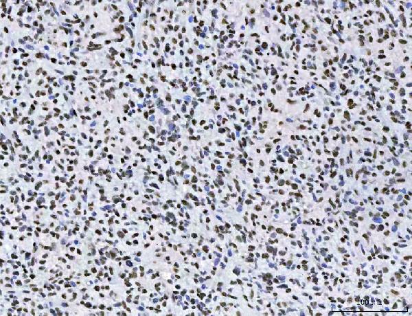 2 - Anti-AREB6/ZEB1 Antibody Picoband™ (monoclonal, 8B12D7) ABO16590