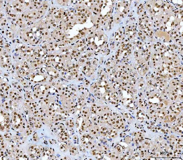 2 - Anti-AREB6/ZEB1 Antibody Picoband™ (monoclonal, 8B12D7) ABO16590