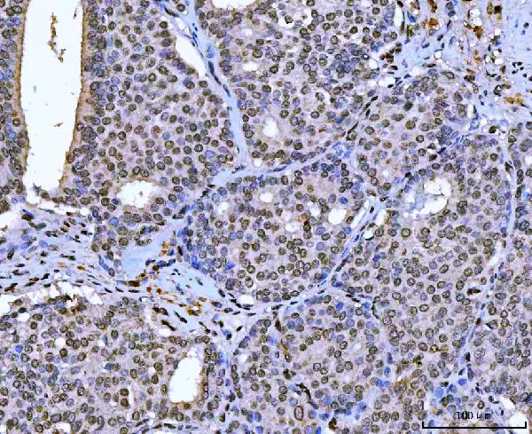 2 - Anti-AREB6/ZEB1 Antibody Picoband™ (monoclonal, 8B12D7) ABO16590