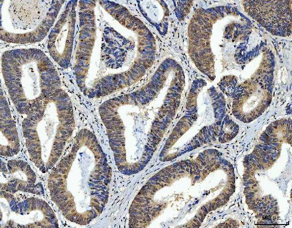 2 - Anti-AREB6/ZEB1 Antibody Picoband™ (monoclonal, 8B12D7) ABO16590