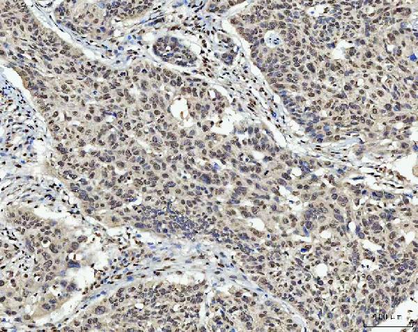 2 - Anti-AREB6/ZEB1 Antibody Picoband™ (monoclonal, 8B12D7) ABO16590