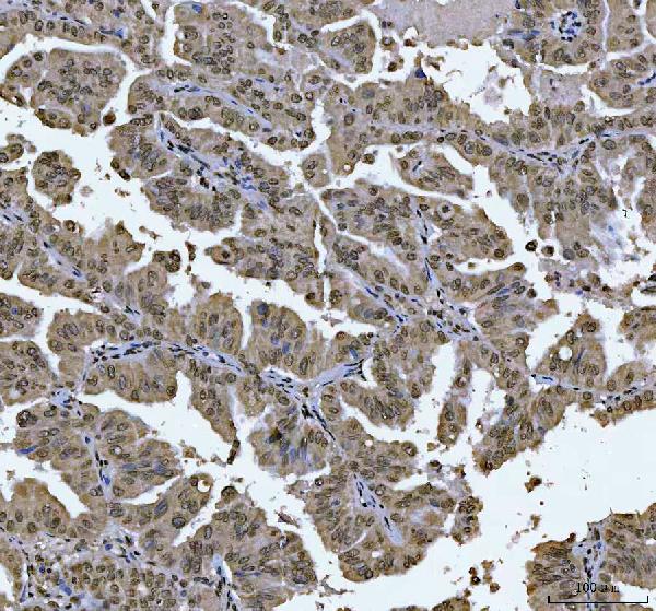 2 - Anti-AREB6/ZEB1 Antibody Picoband™ (monoclonal, 8B12D7) ABO16590