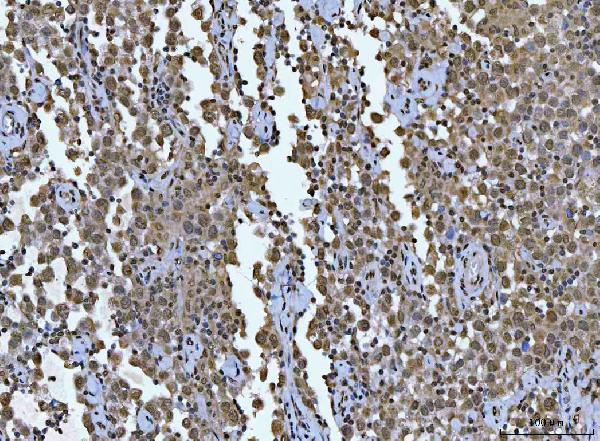 2 - Anti-AREB6/ZEB1 Antibody Picoband™ (monoclonal, 8B12D7) ABO16590