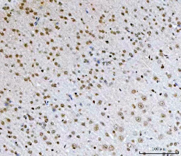 2 - Anti-AREB6/ZEB1 Antibody Picoband™ (monoclonal, 8B12D7) ABO16590