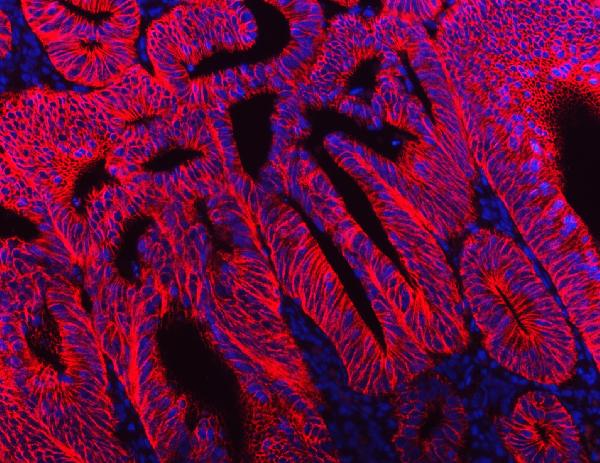 3 - Anti-NKCC1/SLC12A2 Antibody Picoband™ (monoclonal, 6G7D2) ABO16591
