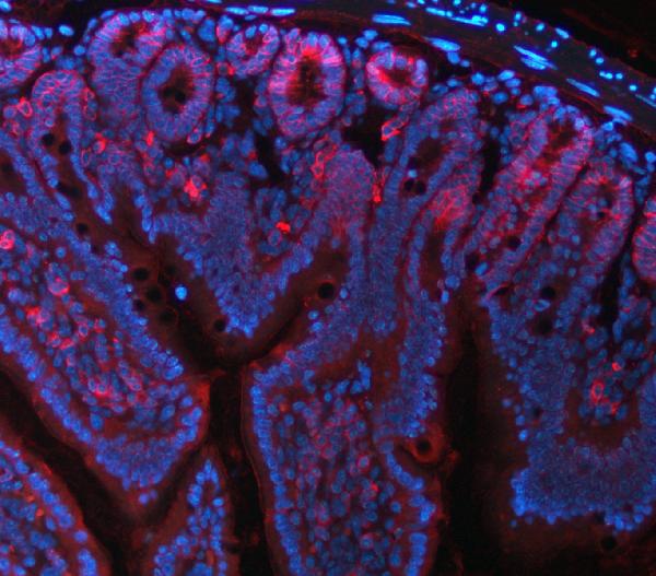 3 - Anti-NKCC1/SLC12A2 Antibody Picoband™ (monoclonal, 6G7D2) ABO16591