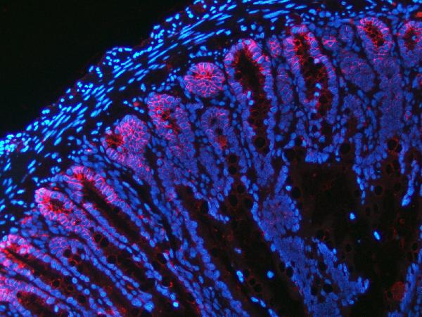 3 - Anti-NKCC1/SLC12A2 Antibody Picoband™ (monoclonal, 6G7D2) ABO16591