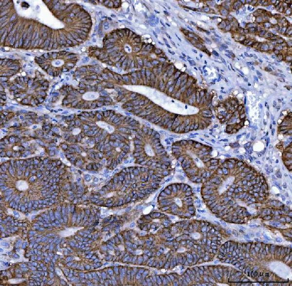 2 - Anti-NKCC1/SLC12A2 Antibody Picoband™ (monoclonal, 6G7D2) ABO16591