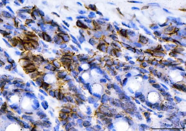 2 - Anti-NKCC1/SLC12A2 Antibody Picoband™ (monoclonal, 6G7D2) ABO16591