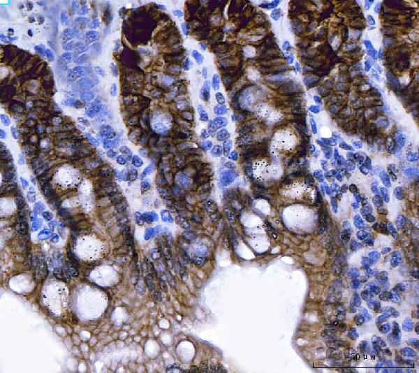 2 - Anti-NKCC1/SLC12A2 Antibody Picoband™ (monoclonal, 6G7D2) ABO16591