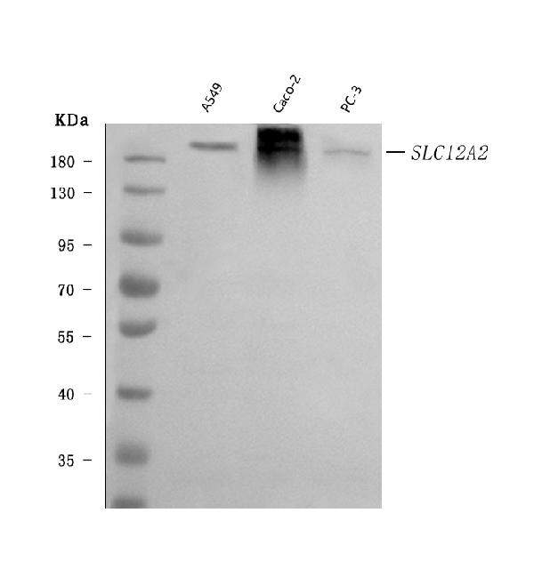 1 - Anti-NKCC1/SLC12A2 Antibody Picoband™ (monoclonal, 6G7D2) ABO16591