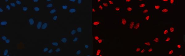 3 - Anti-CPSF6 Antibody Picoband™ (monoclonal, 3F11E1) ABO16592