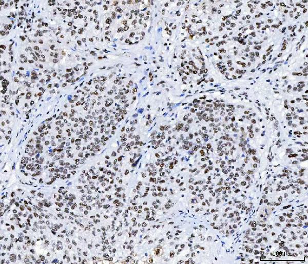 2 - Anti-CPSF6 Antibody Picoband™ (monoclonal, 3F11E1) ABO16592