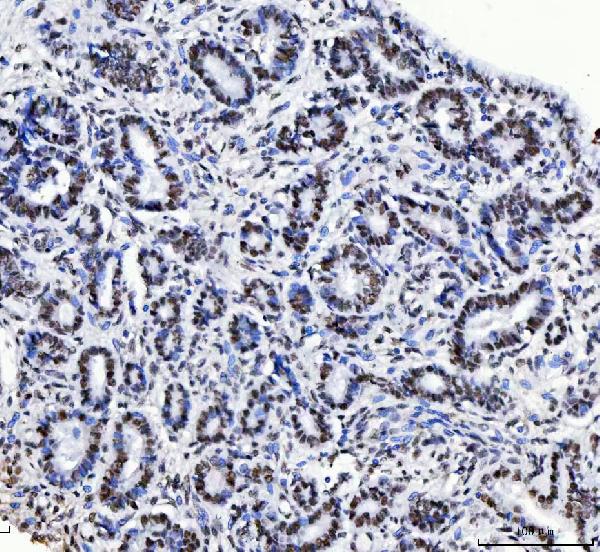 2 - Anti-CPSF6 Antibody Picoband™ (monoclonal, 3F11E1) ABO16592