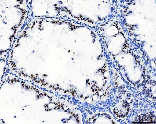 2 - Anti-CPSF6 Antibody Picoband™ (monoclonal, 3F11E1) ABO16592