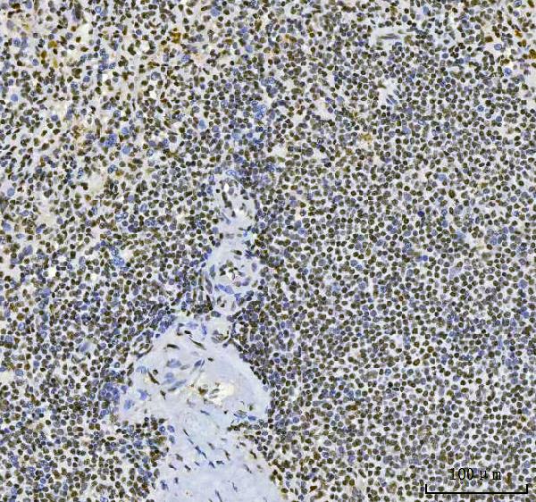 2 - Anti-CPSF6 Antibody Picoband™ (monoclonal, 3F11E1) ABO16592
