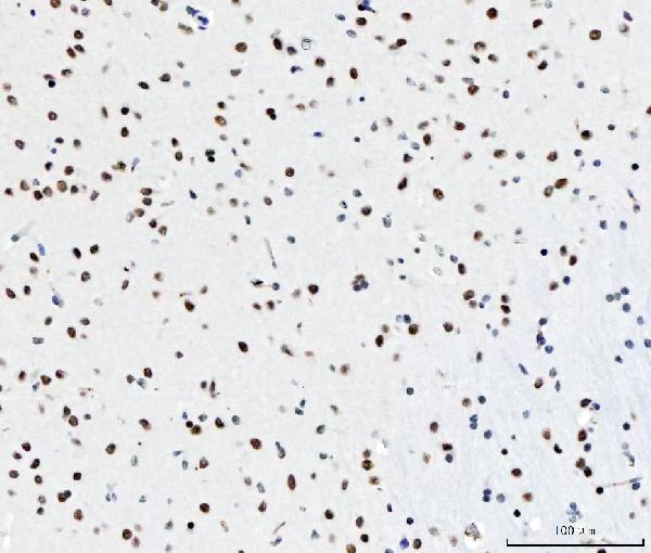 2 - Anti-CPSF6 Antibody Picoband™ (monoclonal, 3F11E1) ABO16592