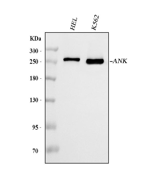 1 - Anti-Ankyrin erythroid/ANK/ANK1 Antibody Picoband™ (monoclonal, 9I6C3) ABO16593