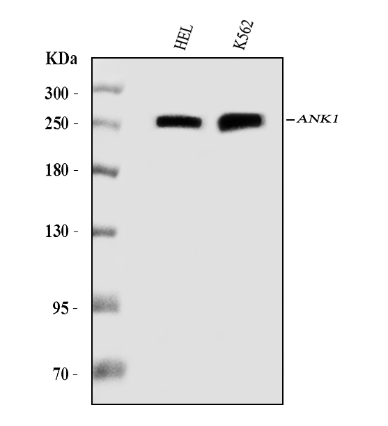 1 - Anti-Ankyrin erythroid/ANK/ANK1 Antibody Picoband™ (monoclonal, 5H2E8) ABO16594