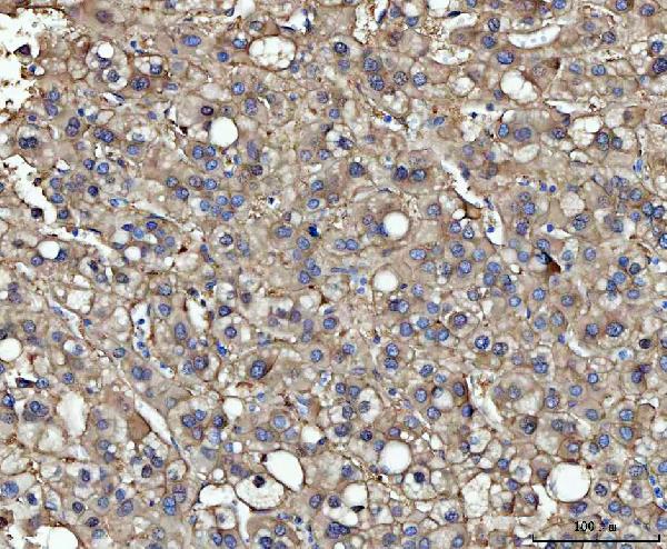 2 - Anti-ME1 Antibody Picoband™ (monoclonal, 5E5F7) ABO16595