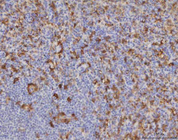 2 - Anti-ME1 Antibody Picoband™ (monoclonal, 5E5F7) ABO16595