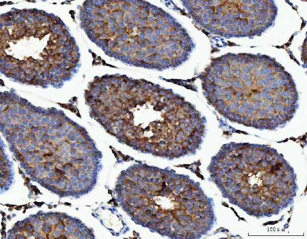 2 - Anti-ME1 Antibody Picoband™ (monoclonal, 5E5F7) ABO16595