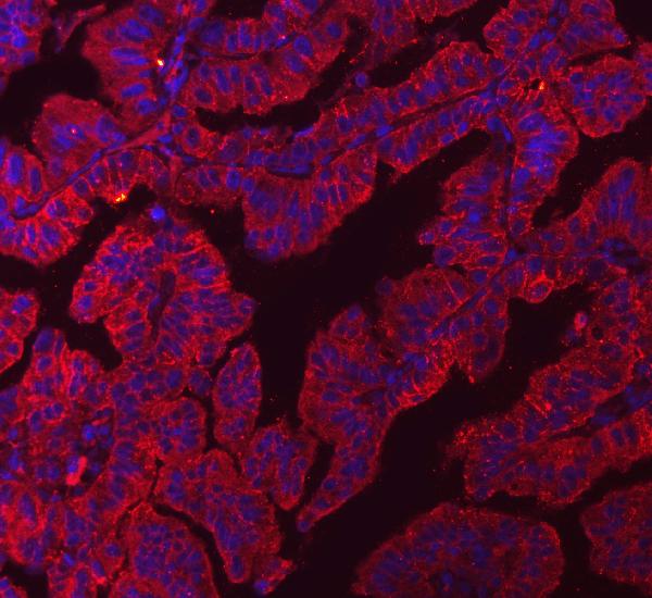 3 - Anti-Claudin 3/CLDN3 Antibody Picoband™ (monoclonal, 4C7D2) ABO16596