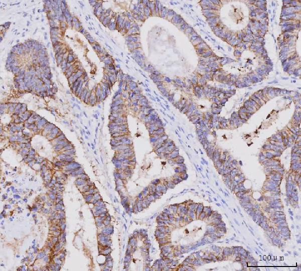 2 - Anti-Claudin 3/CLDN3 Antibody Picoband™ (monoclonal, 4C7D2) ABO16596