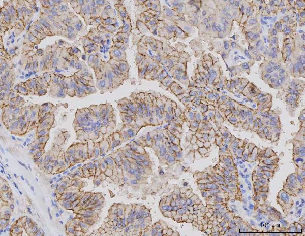 2 - Anti-Claudin 3/CLDN3 Antibody Picoband™ (monoclonal, 4C7D2) ABO16596