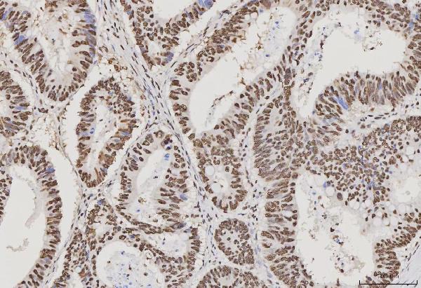 2 - Anti-PC4/SUB1 Antibody Picoband™ (monoclonal, 8D9D1) ABO16597