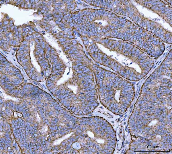 2 - Anti-Calnexin/CANX Antibody Picoband™ (monoclonal, 8D10B3) ABO16598