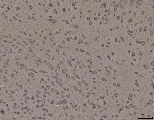 2 - Anti-Calnexin/CANX Antibody Picoband™ (monoclonal, 8D10B3) ABO16598