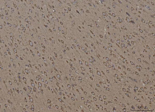 2 - Anti-Calnexin/CANX Antibody Picoband™ (monoclonal, 8D10B3) ABO16598