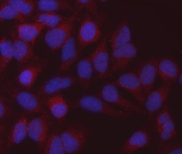 3 - Anti-MDH2 Antibody Picoband™ (monoclonal, 5D8C1) ABO16600