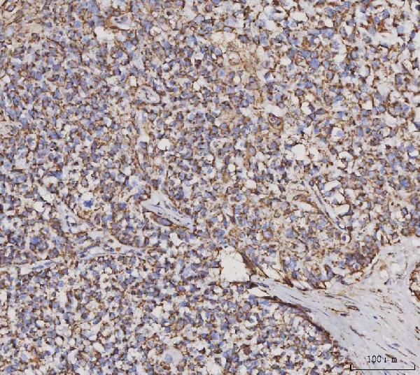 2 - Anti-MDH2 Antibody Picoband™ (monoclonal, 5D8C1) ABO16600