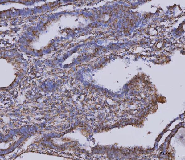 2 - Anti-MDH2 Antibody Picoband™ (monoclonal, 5D8C1) ABO16600