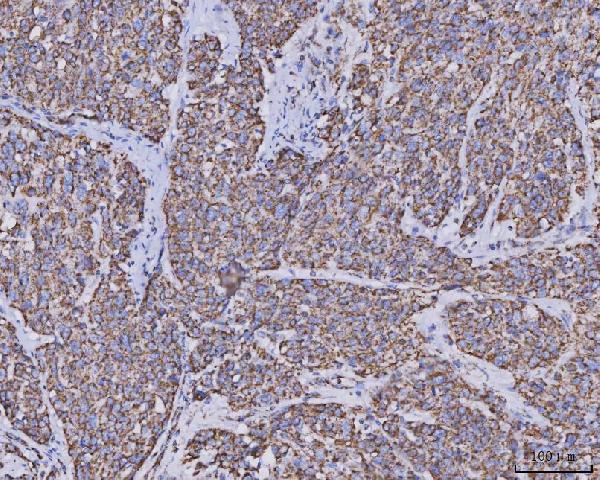 2 - Anti-MDH2 Antibody Picoband™ (monoclonal, 5D8C1) ABO16600