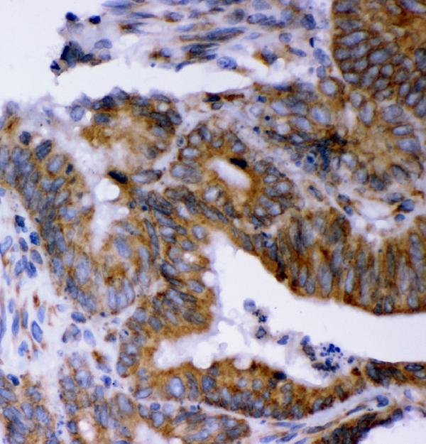2 - Anti-LYRIC Antibody Picoband™ (monoclonal, 2E5G3) ABO16601