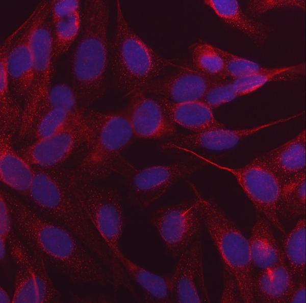 3 - Anti-NDP52/CALCOCO2 Antibody Picoband™ (monoclonal, 9E2F2) ABO16602