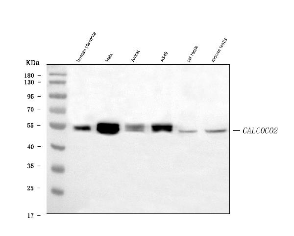 1 - Anti-NDP52/CALCOCO2 Antibody Picoband™ (monoclonal, 9E2F2) ABO16602