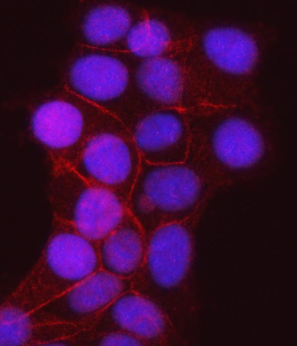 3 - Anti-gamma Catenin Antibody Picoband™ (monoclonal, 4C12D7) ABO16603