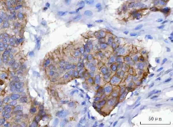 2 - Anti-gamma Catenin Antibody Picoband™ (monoclonal, 4C12D7) ABO16603