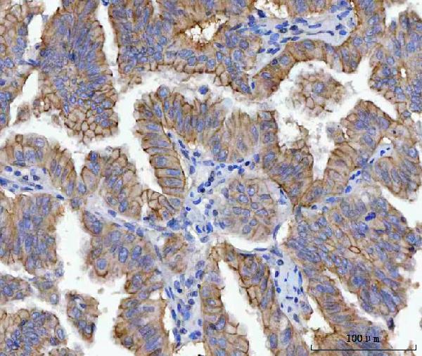 2 - Anti-gamma Catenin Antibody Picoband™ (monoclonal, 4C12D7) ABO16603