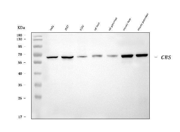 1 - Anti-CBS Antibody Picoband™ (monoclonal, 7C3B7) ABO16605